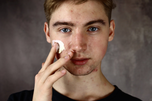 jongeman-mmuk-man-anti-acne-producten-1200x800